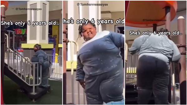 6 Year Old Baby Weighs Arounf 60 Kg How Its Possible