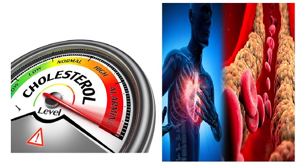 cholesterol