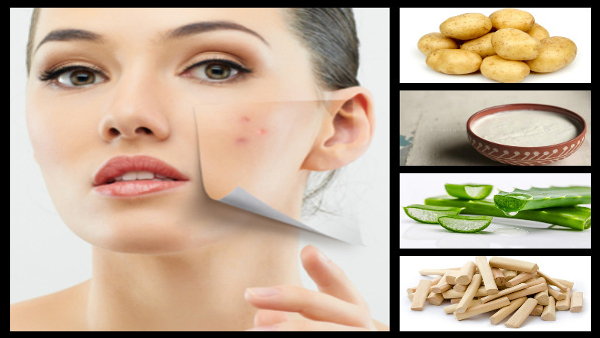 Home Remedies For Black Spots Apply This For 2 Times For Glowing Skin