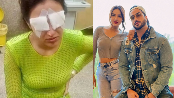 Jasmin Bhasin Actress Corneas Were Damaged After She Wore Lenses