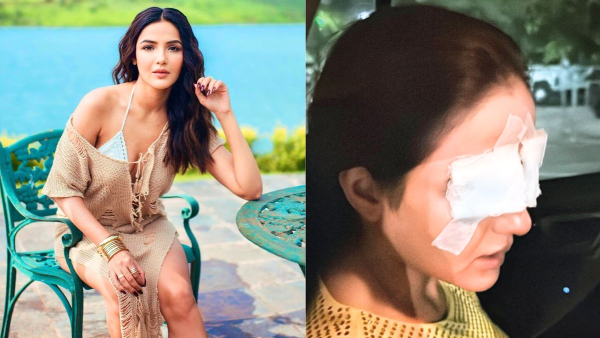 Jasmin Bhasin Actress Corneas Were Damaged After She Wore Lenses