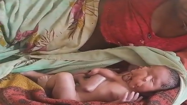 Strange Baby Born With Four Legs Four Arms Two Heads