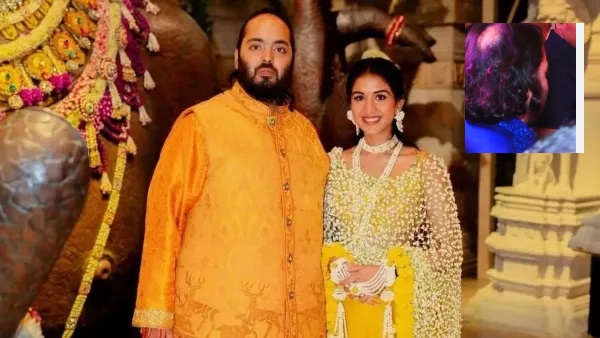 Anant Ambani Hair Loss