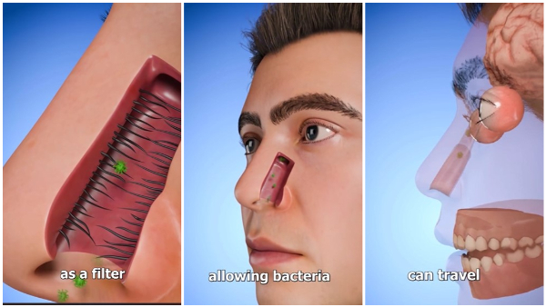 Do You Remove Nose Hair It Could Be Risky