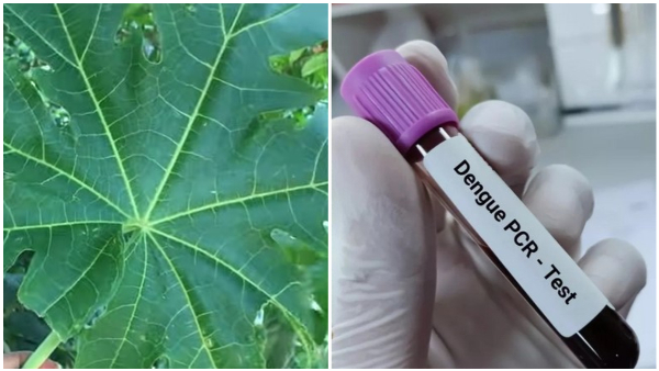 Papaya Cures Dengue How To Use Papaya Leaves For Improve Health