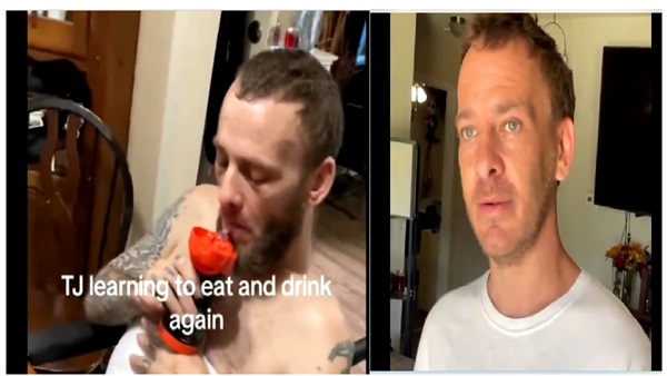 brain dead man lived again