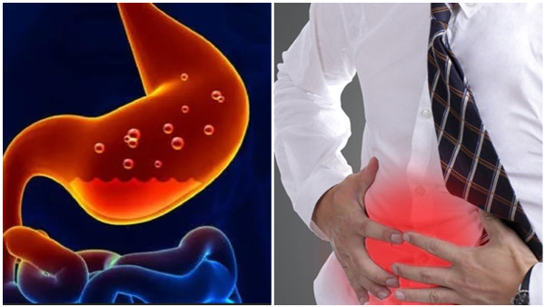 Home Remedies For Acidity Do This Remedy For Acidity