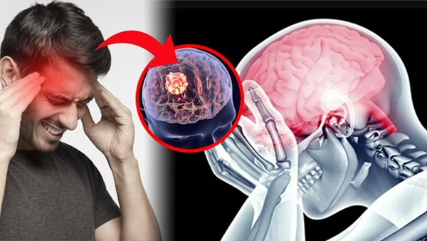 Diet Tips for migraine