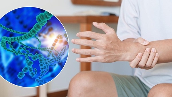 rheumatoid arthritis