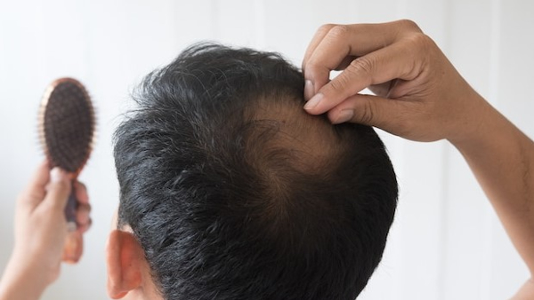 Use This Leaf Paste 3 Times A Week For Excessive Hair Loss