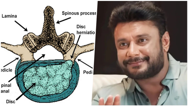 What You Need to Know About His IVDP Diagnosis
