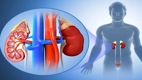 Kidney problem