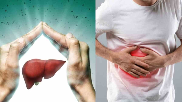 World Liver Day 2025 Don t Ignore These Symptoms May Be An Unhealthy Liver