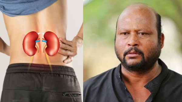 Actor Fish Venkat Dies