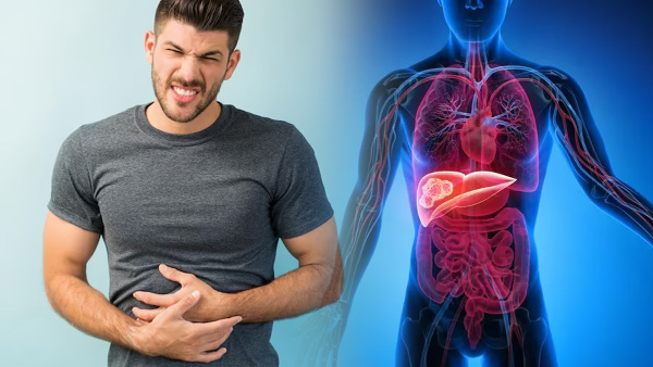 Hepatitis D Linked To Cancer World Health Organization