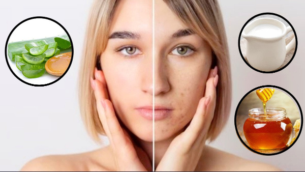 Do You Have Dark Spots On Your Face
