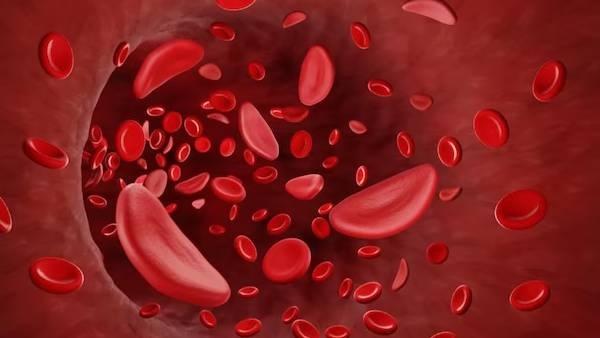 uffering From Anemia