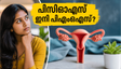 പിസിഒഎസ് (PCOS) ഇനി ചരിത്രം! പേരുമാറ്റത്തിന് പിന്നിലെ ഞെട്ടിക്കുന്ന സത്യം ഇതാണ്