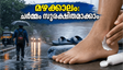 മഴക്കാലത്തെ ചർമ്മ രോഗങ്ങൾ പേടിപ്പെടുത്തുന്നുണ്ടോ? അണുബാധയേൽക്കാതെ സുരക്ഷിതമായി യാത്ര ചെയ്യാൻ ഈ മുൻകരുതലുകൾ മതി