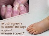 ഹൃദയാഘാതം അടുത്തെത്തിയോ; ലക്ഷണങ്ങള്‍ കൈയ്യും കാലും പറയും