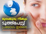 മുഖക്കുരു നീക്കും ടൂത്ത്‌പേസ്റ്റ് പ്രയോഗം ഇങ്ങനെ
