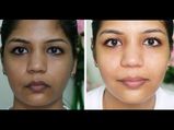  ഒരു തുള്ളി ലെമണ്‍ ഓയില്‍ കരുവാളിപ്പകറ്റും നിശ്ചയം