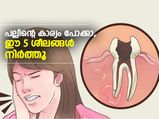 പല്ലിന്റെ കാര്യം പോക്കാ, ഈ 5 ശീലങ്ങള്‍ നിര്‍ത്തൂ