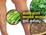 വെരിക്കോസ് വെയിന്‍ തടയാം; ഇതൊക്കെ കഴിച്ചാല്‍ മതി