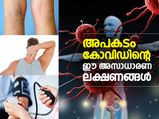 അപകടം കോവിഡിന്റെ ഈ അസാധാരണ ലക്ഷണങ്ങള്‍