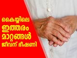 കൈയ്യിലെ ഈ മാറ്റങ്ങള്‍ അവഗണിക്കല്ലേ; ജീവന് ഭീഷണി