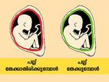  പല്ല് തേക്കുന്നത് പല്ലിന്റെ ആരോഗ്യത്തിന് മാത്രമല്ല; അറിയണം ഇതെല്ലാം