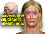 സൈനസൈറ്റിസ് പ്രശ്‌നമാകില്ല; വീട്ടില്‍തന്നെ ചികിത്സിക്കാം