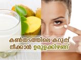കണ്‍തടത്തിലെ കറുപ്പ് നീക്കാന്‍ ഉരുളക്കിഴങ്ങ് പ്രയോഗം