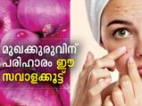 മുഖക്കുരു പമ്പകടക്കും; സവാള ഇങ്ങനെ പുരട്ടിയാല്‍