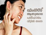 ഫംഗസ് അണുബാധ ഫലപ്രദമായി നേരിടാം; ഈ വീട്ടുവൈദ്യങ്ങളിലൂടെ
