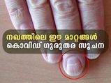 കൊവിഡ് ഉണ്ടോ, അതോ വന്നു പോയോ; നഖം പറയുന്ന ഗുരുതര ലക്ഷണം
