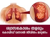 ശ്വാസകോശം ദീര്‍ഘനാളത്തേക്ക് തളരും; കോവിഡ് വന്നുമാറിയാല്‍ ജീവിതം മാറ്റണം