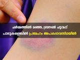  പ്രമേഹം മൂര്‍ദ്ധന്യാവസ്ഥയിലെങ്കില്‍ ചര്‍മ്മത്തിലെ  മാറ്റം