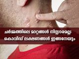 തൊലിപ്പുറത്തുണ്ടാവും ലക്ഷണങ്ങള്‍ കരുതിയിരിക്കണം: കൊവിഡ് ഇങ്ങനേയും