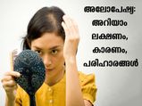 അലോപേഷ്യ നിസ്സാരമല്ല: എന്താണ് അലോപേഷ്യ, കാരണങ്ങളും ലക്ഷണങ്ങളും