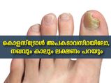 കൊളസ്‌ട്രോള്‍ ശരീരത്തില്‍ അപകടാവസ്ഥയിലോ, കാലിലറിയാം പ്രധാനമാറ്റം