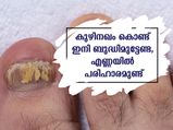 കുഴിനഖത്തിന് കണ്ണടച്ച് തുറക്കും മുന്‍പ് മാറ്റം വരുത്തും എണ്ണകള്‍