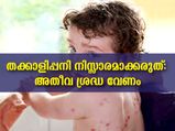  തക്കാളിപ്പനി കുട്ടികളില്‍ പിടിമുറുക്കുന്നു: ശ്രദ്ധിക്കണം ഓരോ ലക്ഷണവും