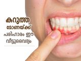 മോണയിലെ കറുപ്പ് നീക്കി പിങ്ക് കളര്‍ മോണ നേടാം; ഈ വീട്ടുവൈദ്യങ്ങള്‍ ഫലപ്രദം