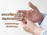 ശ്രദ്ധിച്ചില്ലെങ്കില്‍ പ്രശ്‌നമാകും; സോറിയാറ്റിക് ആര്‍ത്രൈറ്റിസ് ലക്ഷണങ്ങളും ചികിത്സയും