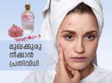 മുഖക്കുരു മായ്ഞ്ഞുപോകും മുഖം തിളങ്ങും; റോസ് വാട്ടര്‍ ഈവിധം പുരട്ടൂ