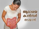 വേഗത്തില്‍ പടരുന്ന ആമാശയ ക്യാന്‍സര്‍; രക്ഷനേടാന്‍ ഈ ജീവിതശൈലി മാറ്റം 