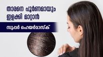 താരനില്ല, മുടി കൊഴിച്ചിലില്ല, പൂര്‍ണ പരിഹാരം നാരങ്ങ നീരില്‍