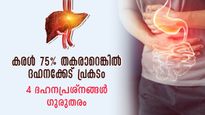 വയര്‍വീര്‍ക്കല്‍, വയറുവേദന, മലബന്ധം: സ്ഥിരമെങ്കില്‍ കരള്‍ ഗുരുതരാവസ്ഥയില്‍