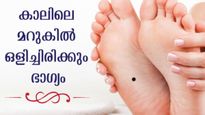 സാമുദ്രിക ശാസ്ത്രപ്രകാരം കാലില്‍ മറുകെങ്കില്‍ ഫലം ഇപ്രകാരം